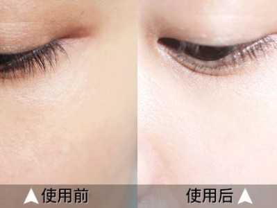 日本腾素效果如何？实测30天揭秘真相与避坑诀窍优质